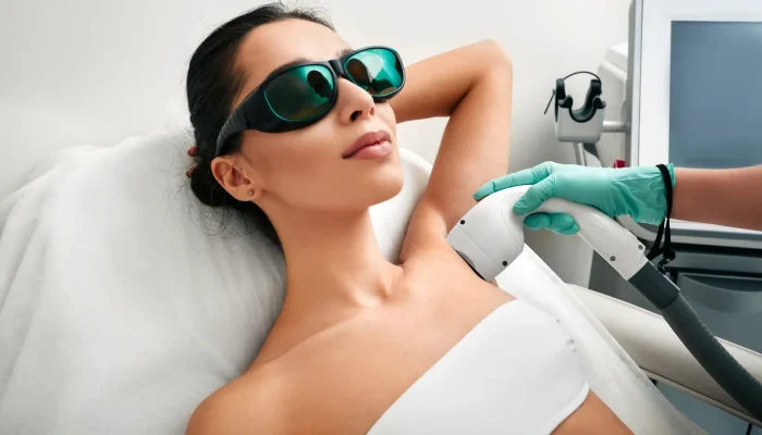Como fazer depilação a laser